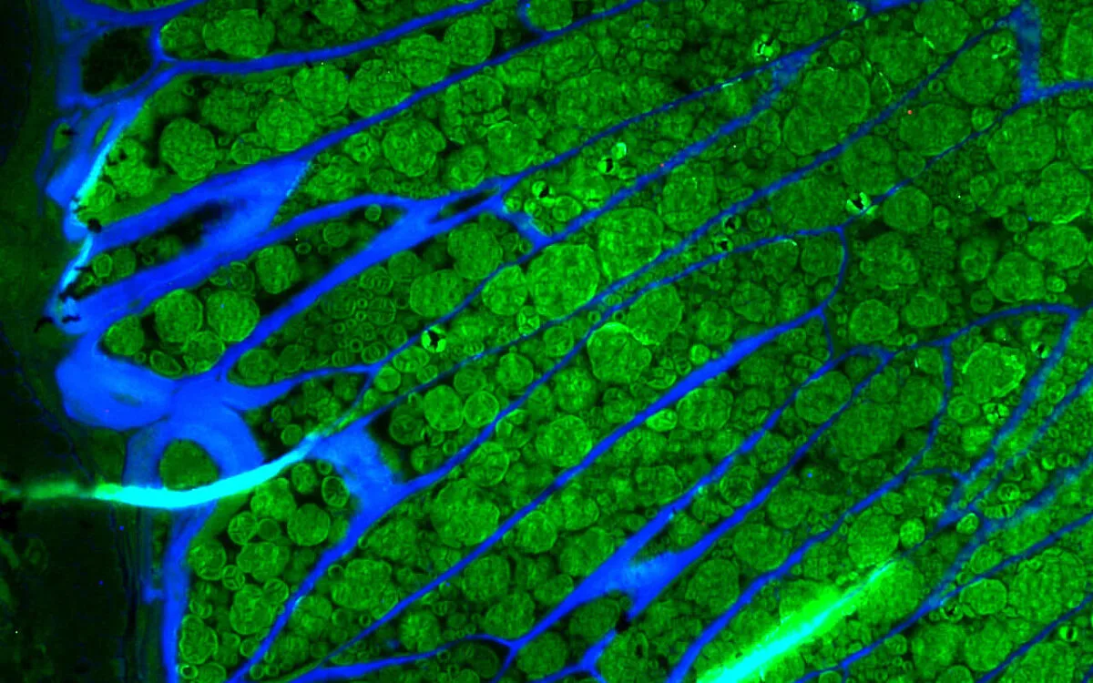 compressed-d515edb6586a8607dfd45ed4b0c8bb5e-webp